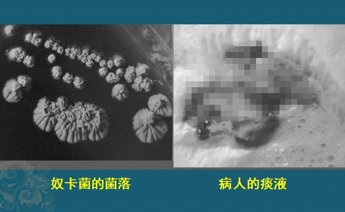 这个细菌提醒你,别买病死的鱼,它是个吃草的细菌,后来学会吃鱼