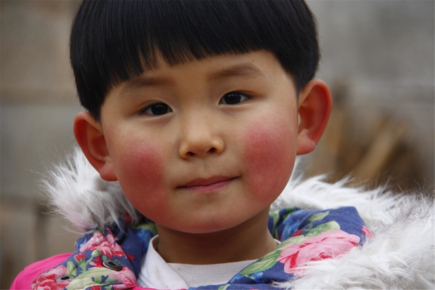 宝宝的皮肤一到秋天就干燥发红,宝宝秋季脸干燥发红怎么办