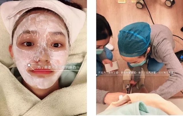 林允小红书说的话,林允小红书推荐卷发