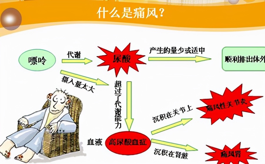 痛风喝什么茶能预防痛风发作,痛风饮食和治疗误区