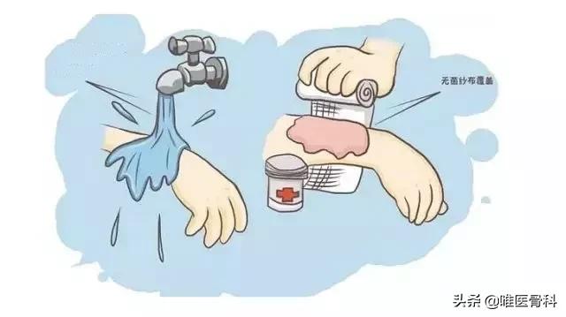 常用的四种消毒液,消毒液一般情况下是不建议用