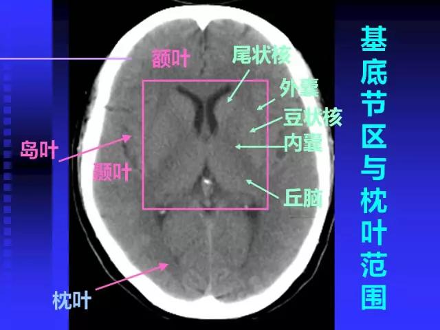 头颅mri读片视频教程,颅脑mri读片入门教程视频讲解全集