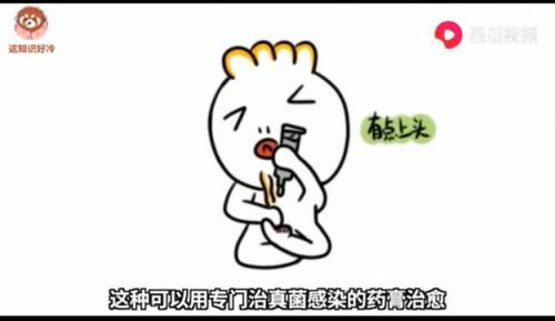 脚酸臭味怎么解决抑菌防臭,刺鼻性脚臭