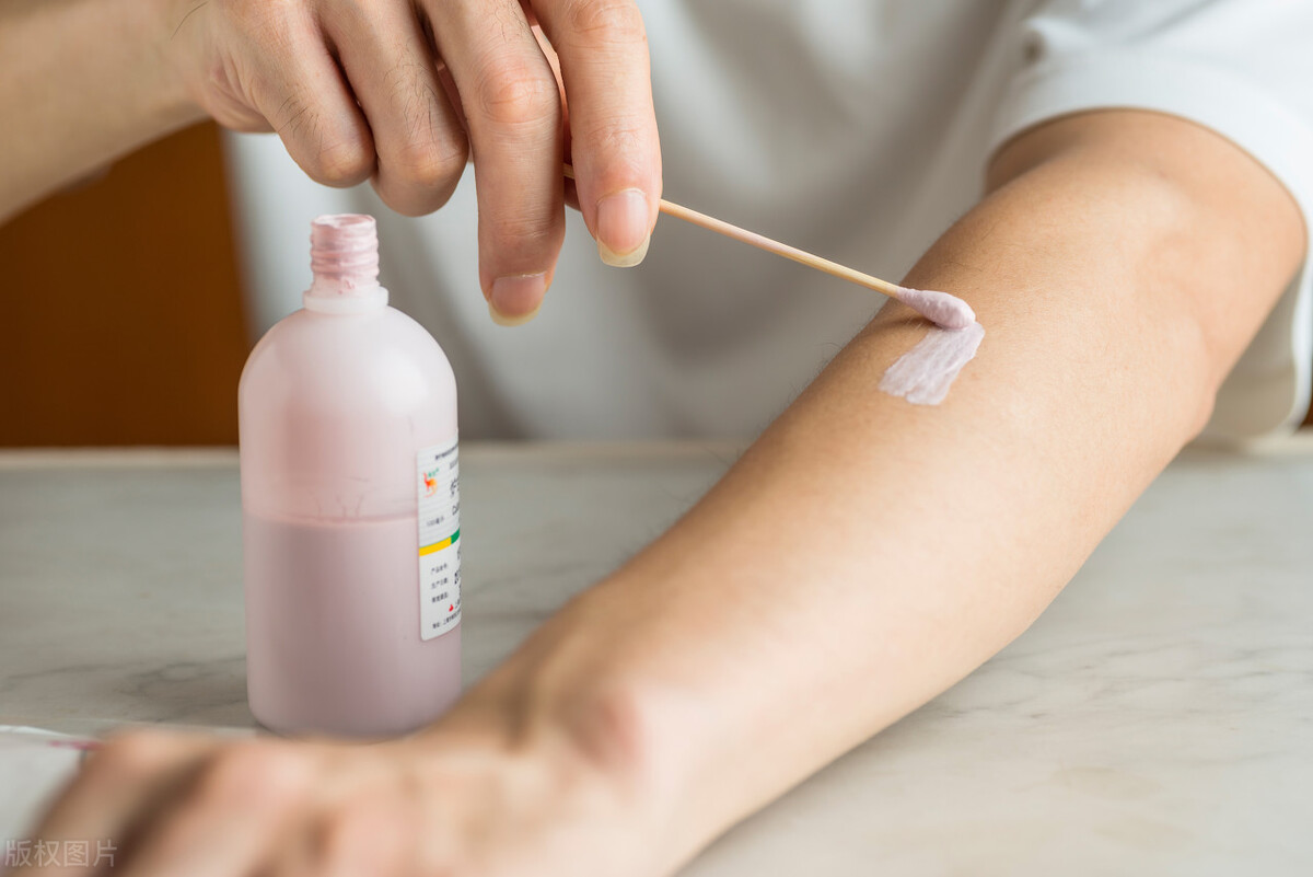 皮肤瘙痒用什么药止痒效果最好,小腿瘙痒用什么药膏快速止痒