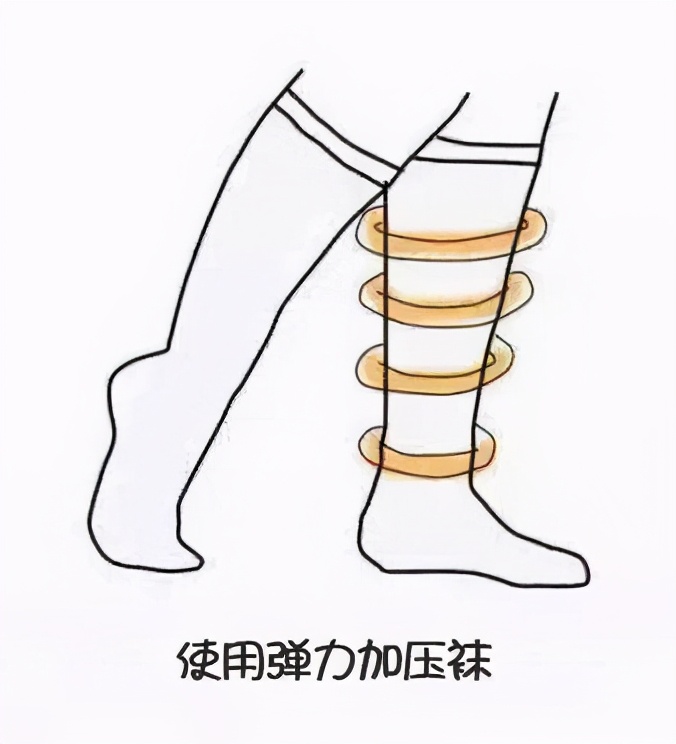 压缩袜的作用,压缩袜子的功效与作用