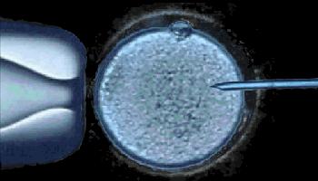 阿sa林志玲宋慧乔,阿sa徐静蕾林志玲