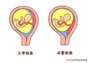 怀孕期间最怕见红!刘博士教你淡定应对