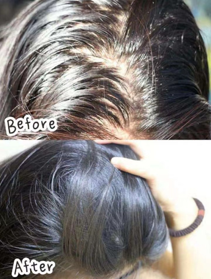 脱发少女自救法,当代脱发女生的日常表现