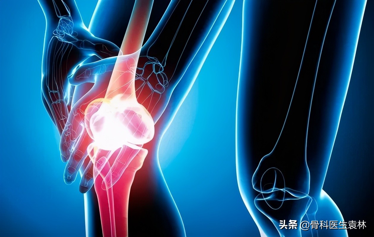 膝盖疼滑膜炎是什么症状呢,膝盖疼滑膜炎怎么治疗最好最有效