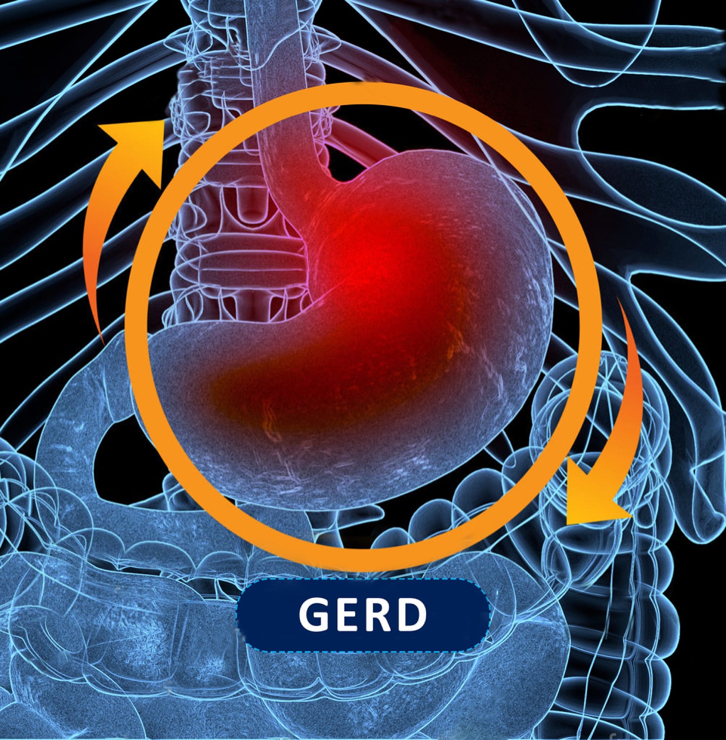 腹痛的各种病因图解,腹痛的病因及发病机制图