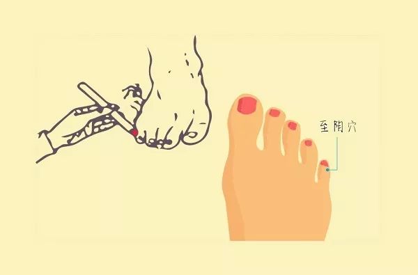 臀位想顺产怎么办,头臀位双胞胎顺产