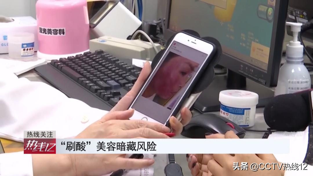 刷酸祛痘焕肤,刷酸能去激素脸的痘痘吗