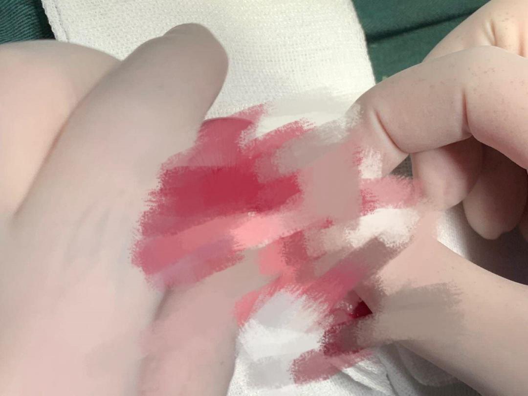 “我居然从猫屁股拽出了一根针！太可怕了！”