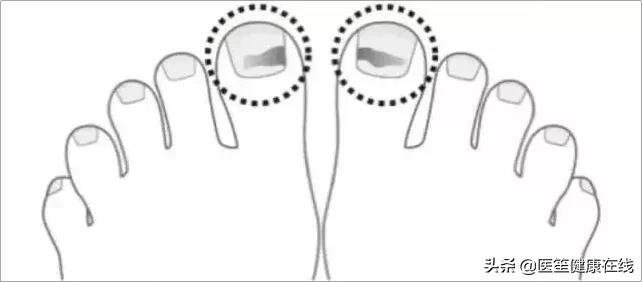 脚部7种症状是大病来临的前兆,脚部15种症状暗示哪些疾病