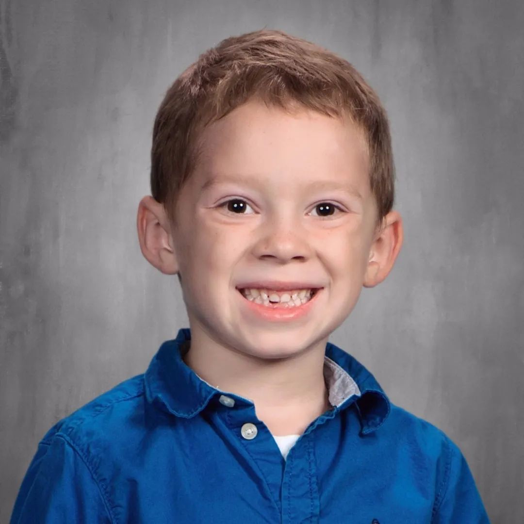 怎么练出angelababy微笑唇,angelababy演技微笑唇