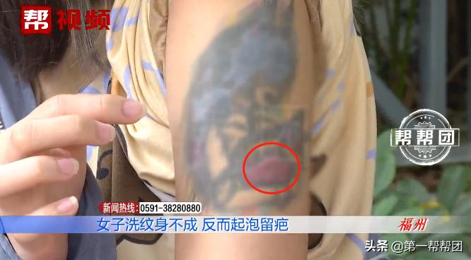 洗纹身后发炎起脓会留疤吗,洗纹身后起水泡了会留疤吗