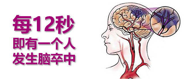 FES在脑卒中康复治疗中的应用分析