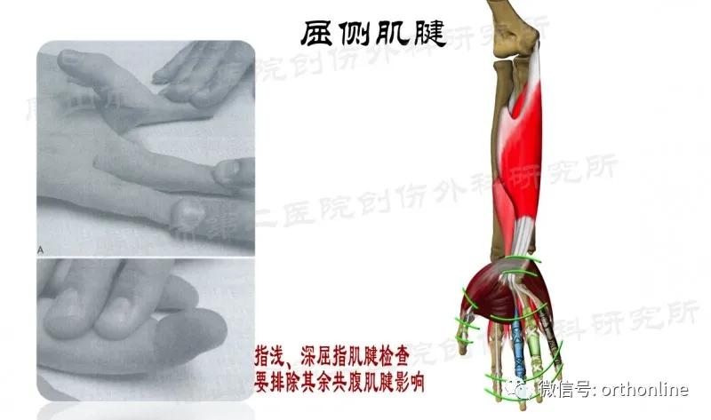 手部肌腱不完全断裂能完全复原吗,手部屈指肌腱损伤最难处理的部位