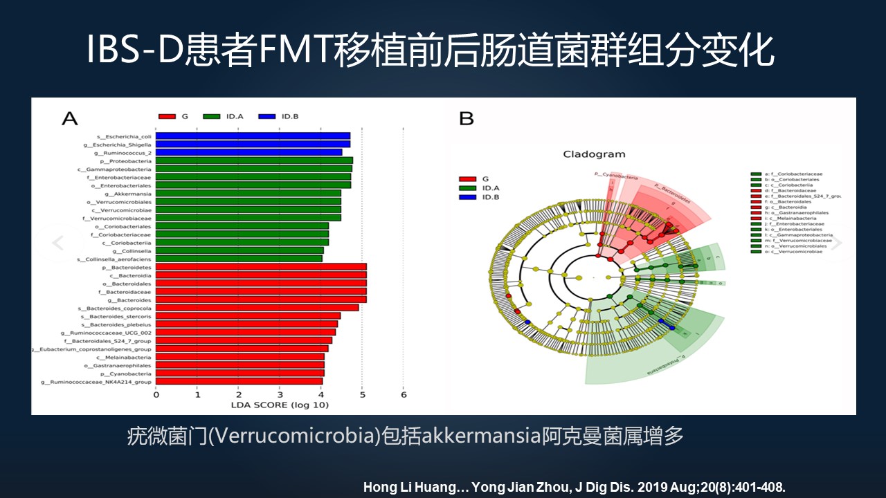粪菌移植能治疗肠易激综合征吗,肠易激综合征能粪菌移植治疗吗
