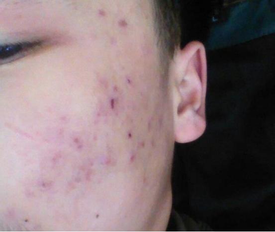 男士护肤推荐套装油痘肌平价,男士控油收缩毛孔护肤品测评推荐