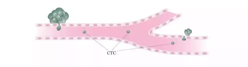 肿瘤早期筛查体检ppt,ctc发现2个循环肿瘤细胞
