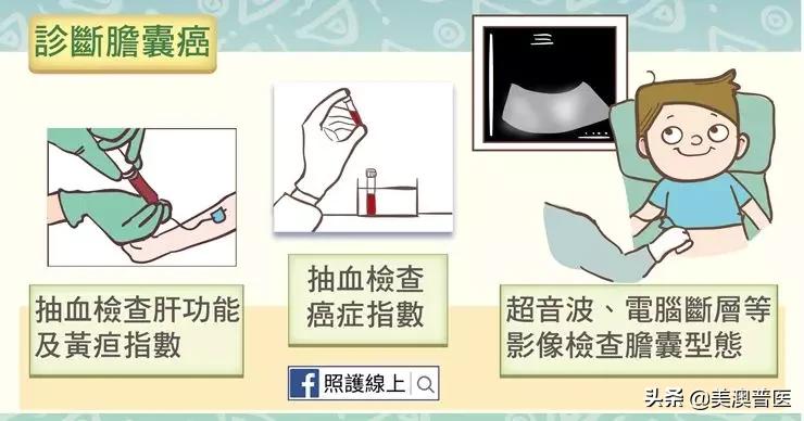 胆结石不治疗会拖成胆囊癌？有几点要特别注意