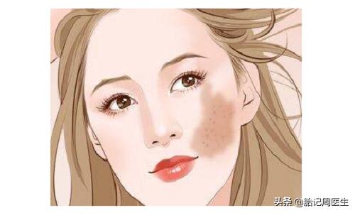 褐色胎记在家处理,褐色椭圆形胎记民间说法