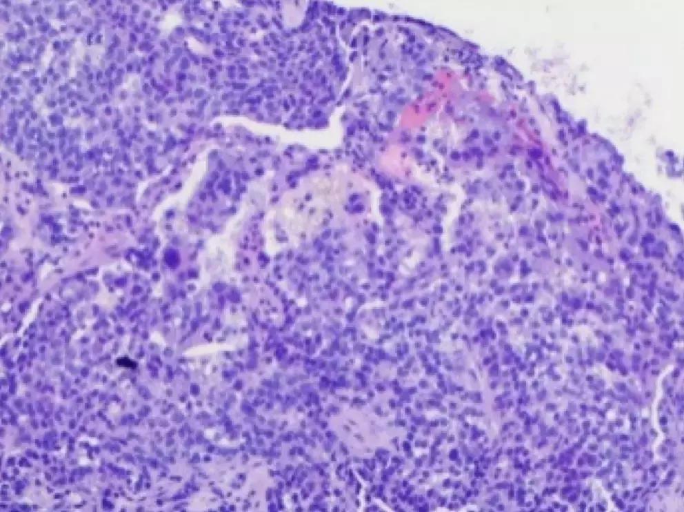 抗菌药物不合理处方分析,抗菌药物用药不合理的表现