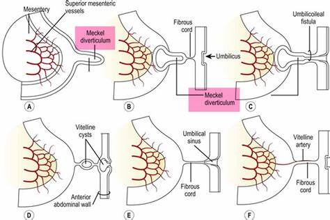 卵黄囊瘤是睾丸癌吗,卵黄囊瘤是不是生殖细胞瘤