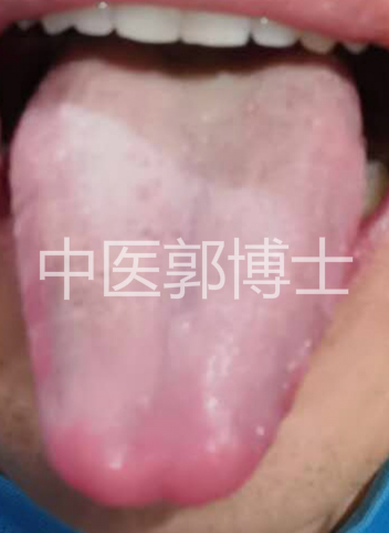 肾精亏虚咳嗽是什么症状,夜间咳嗽肾水亏虚