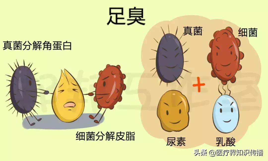 脚气不治大概自己怎么能好,能彻底治愈脚气的高效好药排名