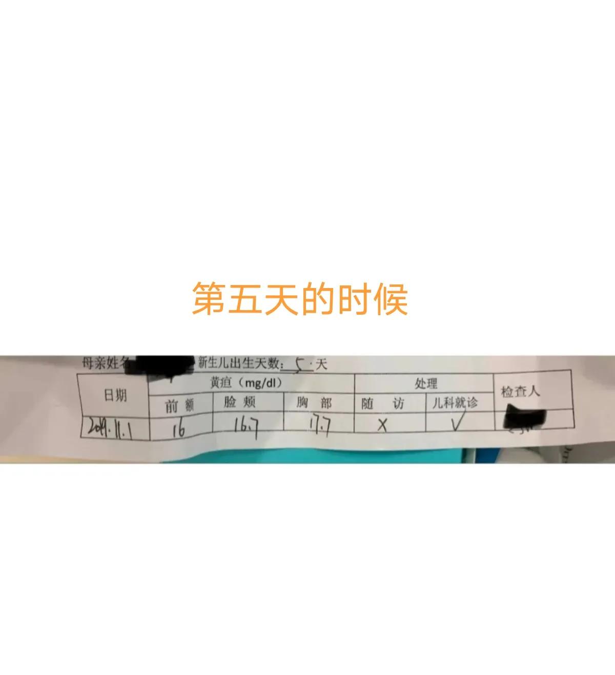 宝宝黄疸好转有哪些征兆,亲身经历宝宝黄疸过程