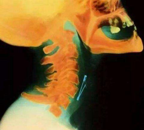 不作死就不会死看看你中了几条,不作死就不会死让人看的头皮发麻