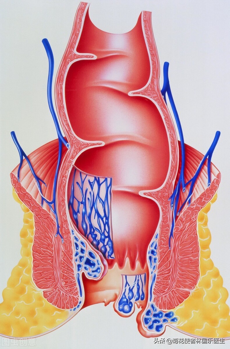 痔疮手术真的可以不疼吗,痔疮手术后晚上疼的睡不着怎么办