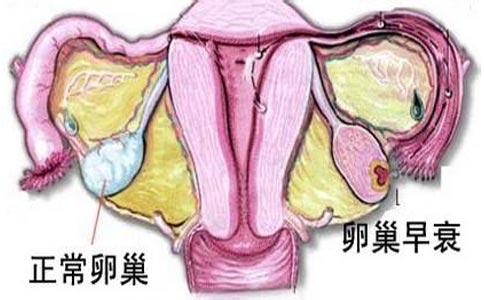 闭经，雌激素低，不孕……卵巢疾病需辩证治疗，对症下药