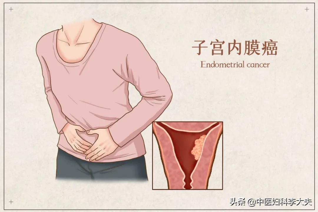 子宫腺肌症子宫增大怎么办,子宫增大是什么原因引起的
