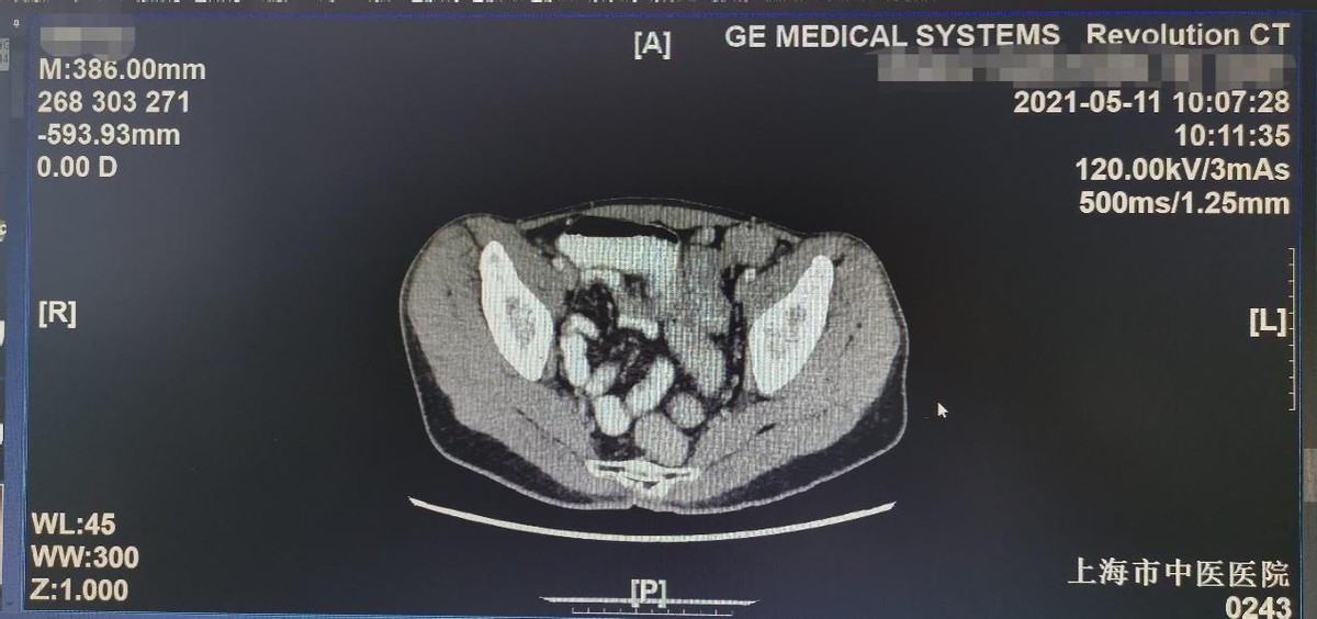 朱光辉医师,朱光辉骨科