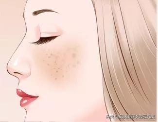 做一个脸上无斑的女人,女人脸上没有斑了