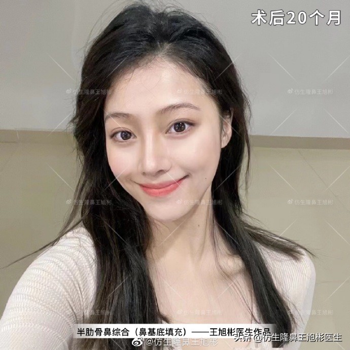 被鼻子封印的颜值,那些被鼻子封印的颜值