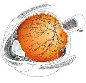 治疗视网膜静脉阻塞的药,眼睛视网膜静脉阻塞做高压氧