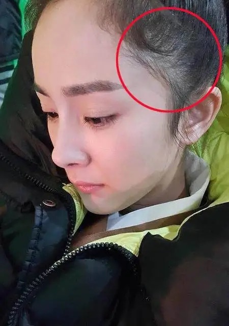 蒋梦婕植发是哪一期,蒋梦婕植发视频完整版