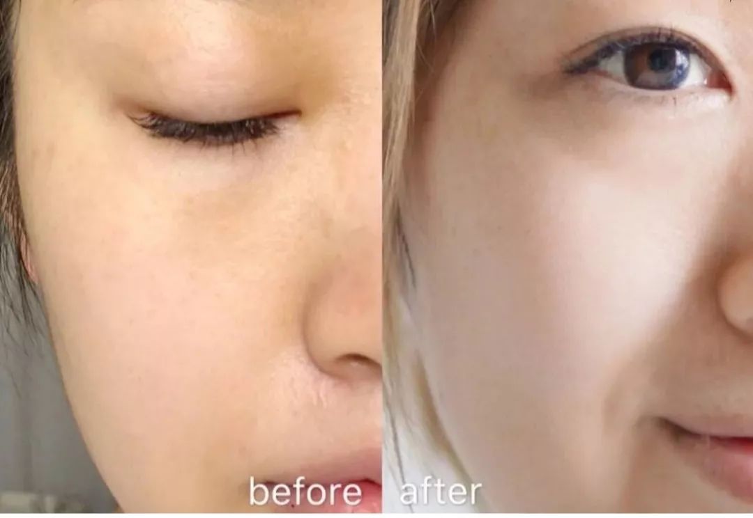 一年四季都能用的保湿面霜,皮肤干推荐一款好用的面霜