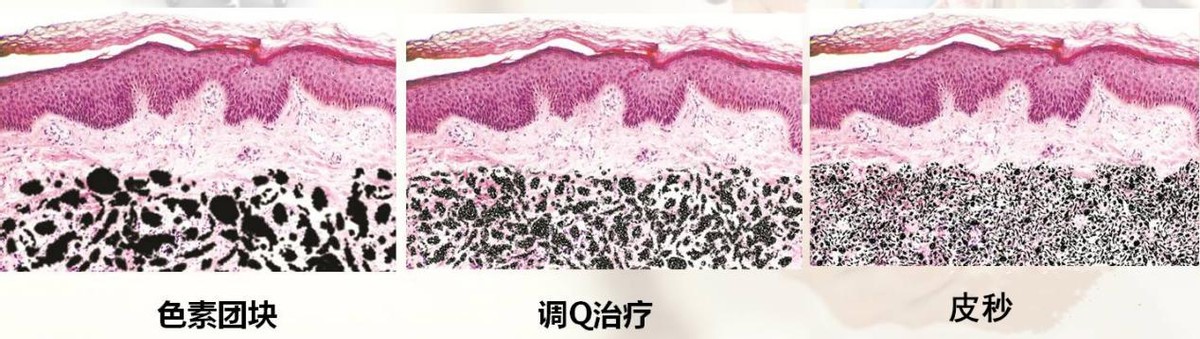 女人脸上有斑吃什么药可以祛斑,脸上长斑吃什么中药调理祛斑