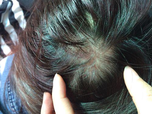 洗发露油性头发推荐,油头用了滋润洗发水