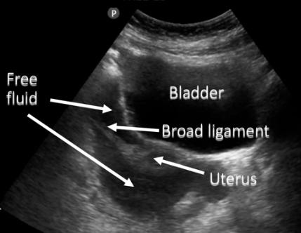 女人过度透支的危害,女人过度透支身体危害是什么