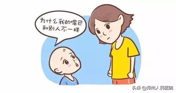 兔唇修复成功视频,完美修复系列