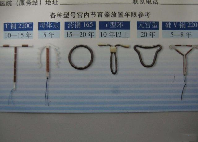 上环6年从孕妇体内取出纱布,宝妈上节育环
