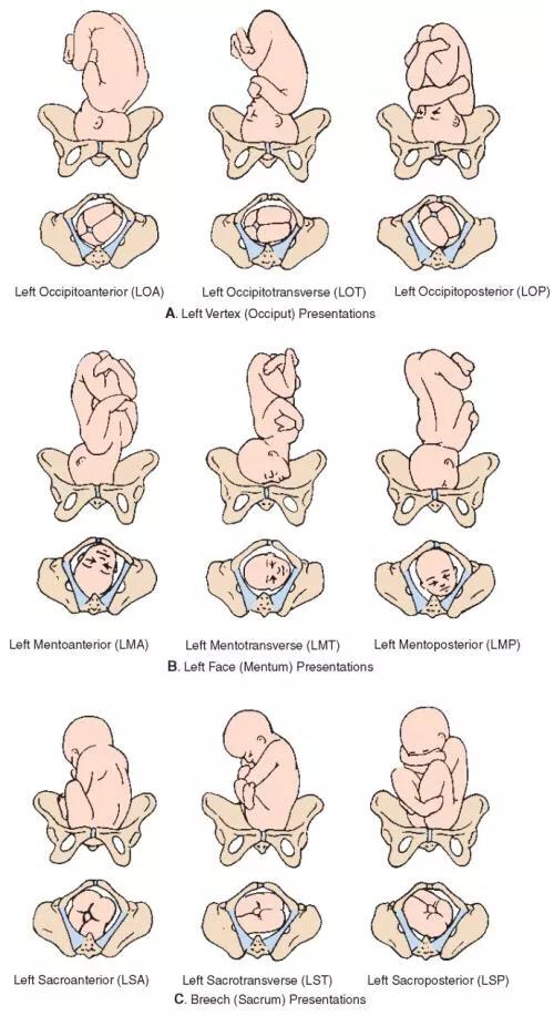 胎儿如何检查智力发育,b超单怎么看出胎儿boy还是girl
