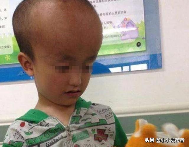 吃了三鹿奶粉的娃娃现在怎么样了,三鹿奶粉造成的大头娃娃现状视频