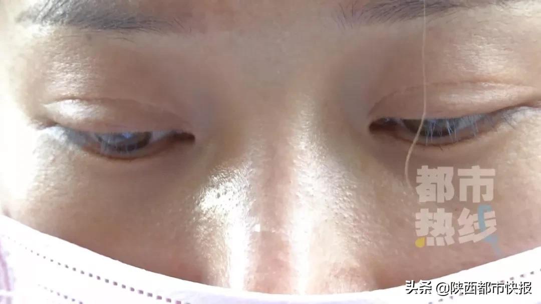 女子隆鼻失败花万元,女子花5万隆鼻结果鼻梁歪斜